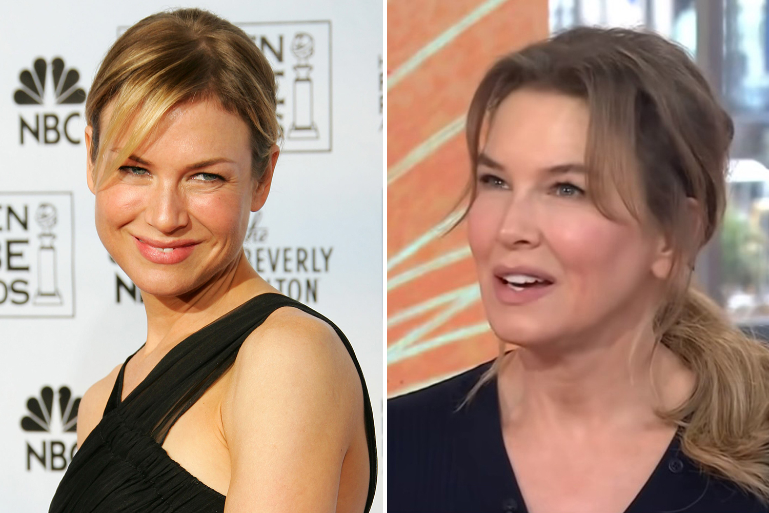 We Can't Believe It's Her! Renée Zellweger's Dramatic Transformation for New Film 'Pam' Revealed